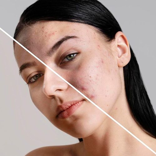 before-after-portrait-woman-retouched-1-e1721137662860