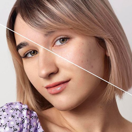 before-after-portrait-woman-retouched-2
