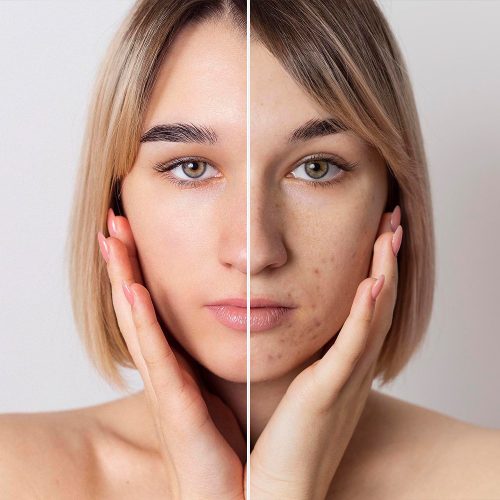 before-after-portrait-woman-retouched