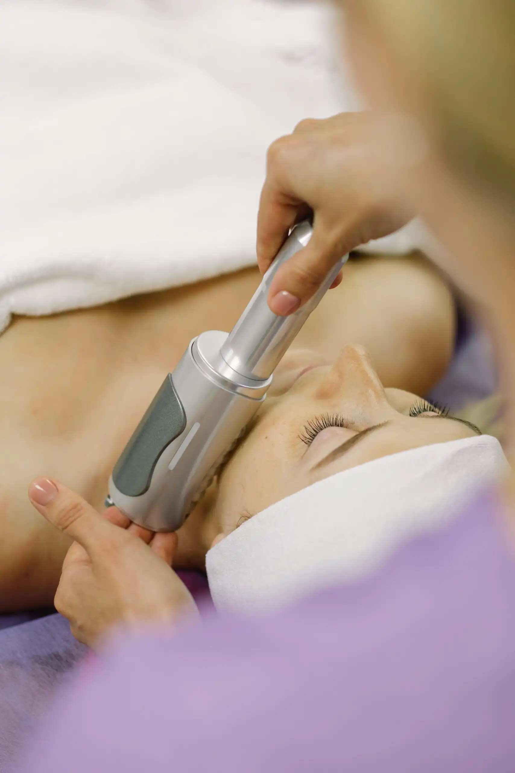 Dermal Fillers Before and After Results